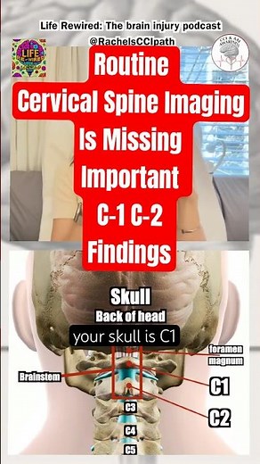 Routine Cervical Spine ImagingCan MissImportant C1 C2 Findings