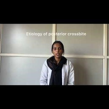 Posterior Crossbite