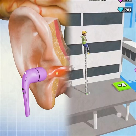 How Hearing Works 🤨