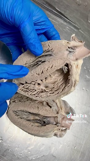 Anatomía de los Ventrículos del Corazón: Guía Completa