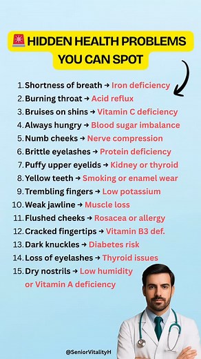 Your body often reveals silent health problems through small physical changes especially for seniors over 50 who should monitor early warning signs closely. Shortness of breath can suggest iron deficiency and low oxygen levels in the blood. A burning throat may come from acid reflux damaging the esophagus. Bruises on the shins can point to low vitamin C, which weakens blood vessels. Constant hunger may signal blood sugar imbalance, while numb cheeks could indicate nerve compression or circulatio