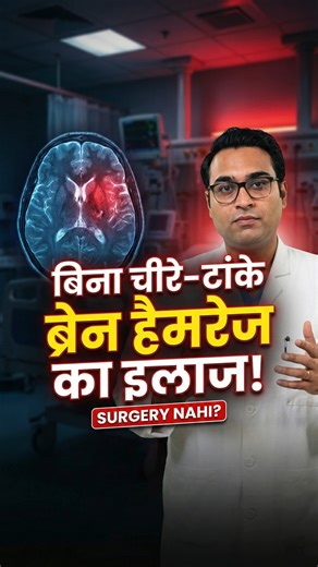Dr Gaurav Chauhan | ब्रेन हेमरेज (मस्तिष्क में रक्तस्राव) का बिना ऑपरेशन इलाज संभव है | Dr Gaurav Chauhan आज Brain Aneurysm (ब्रेन की धमनी में गांठ/फुलाव) के... | Instagram