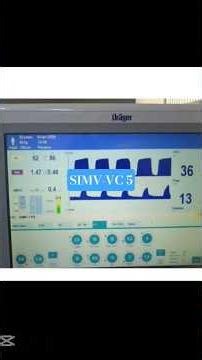 SIMV-VC 5 #mechanical_ventilation #foryou #اكسبلور #nurse