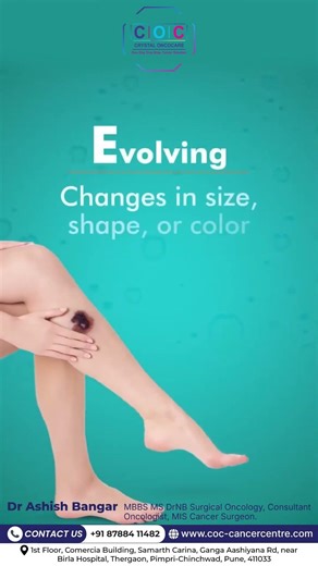 Don’t Ignore the Signs: The ABCDEs of Skin Cancer 🎗️