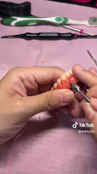 Complete Denture Festooning Stage in Prosthodontics