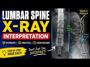LUMBAR SPINE X-RAY INTERPRETATION MADE EASY