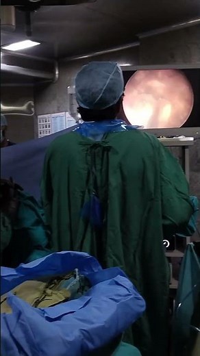 Cystolithotripsy | Removal of Urinary Bladder Stones