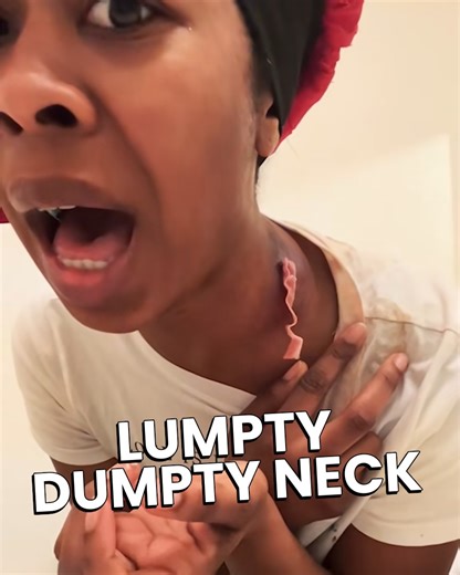 6.8K views · 14 reactions | She lived with a huge cyst on her neck — and now she’s sharing her journey from swelling to healing.  No removal footage here, just raw honesty and the incredible transformation that followed. #HealingJourney #CystRecovery #RealLifeStories #BeforeAndAfter #BodyPositivity #HealthAwareness | Awesome Videos | Facebook