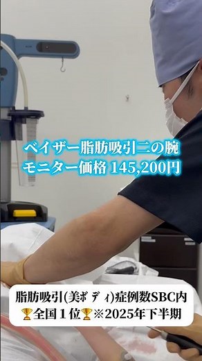 ベイザーで脂肪をしっかり吸引して真っ直ぐな二の腕に💪🏻✨ #ダウンタイム #脂肪吸引