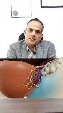 Precision that protects. Retzius sparing robotic prostate cancer surgery for faster recovery.