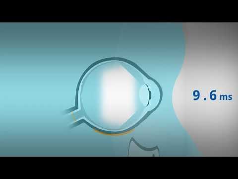 RETeval DR Protocol Overview