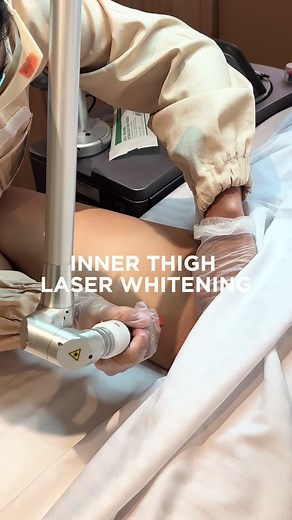 Discover the Benefits of Wink's Inner Thigh Laser Whitening! 😉✌🏽 #WinkLaserStudio #InnerThighWhitening #LaserWhitening