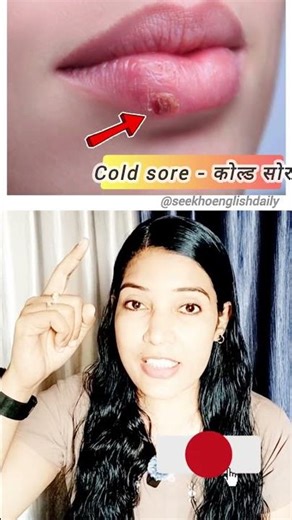 Common Skin & Eye Problems in English (Easy Vocabulary!) #shortsfeed #skin #eye #problem #vocabulary