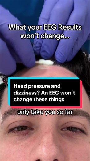 Understanding EEG for Managing Dizziness and Head Pressure