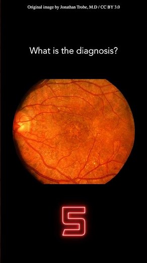 Fundoscopy Question 24