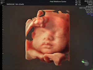 Wellbeing Scan | Teh Fetal Medicine Centre