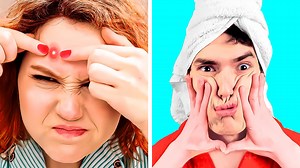 308K views · 1.8K reactions | If pimples were your friends. Funny situations and awkward moments you can relate to: | 5-Minute Crafts Family | Facebook