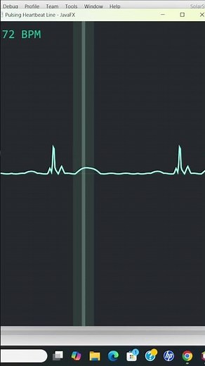 JavaFX ECG Animation — Real Heartbeat, Neon Glow, Smooth Motion #shorts