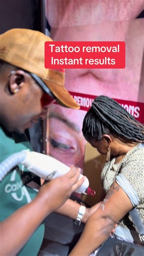 Tattoo removal instant results: how to remove unwanted tattoos