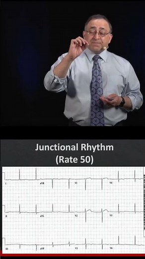 Junctional Rhythm Example ❤️📈 #shorts