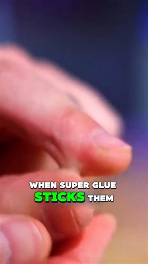 When Super Glue Sticks to Your Finger