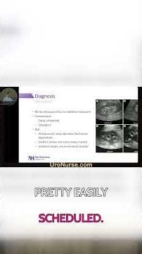 Detect Kidney Stones: CT vs Ultrasound in Stone Diagnosis
