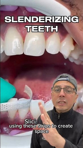 Performing an Interproximal Reduction for Invisalign | In Office to Hands On Dental Training #shorts