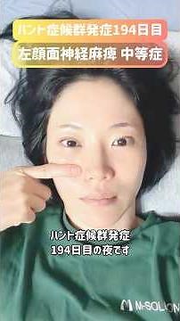 【発症194日目】気候の変化に自律神経おいてけぼり #ハント症候群 #顔面神経麻痺 #リハビリ #闘病中 #回復期