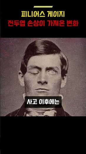 피니어스 게이지, 전두엽 손상과 행동 변화🧠