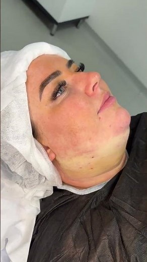 Surgery: A Comprehensive Guide to Procedures, Recovery, and Transformative Outcomes