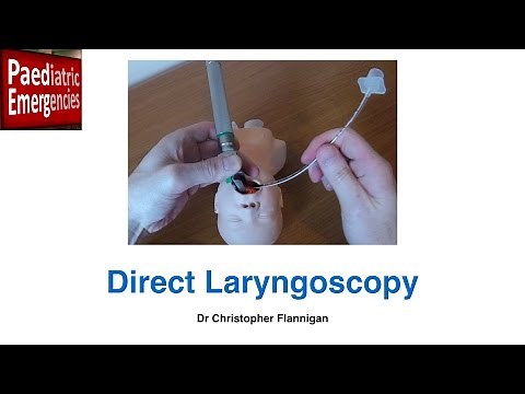 Direct Laryngoscopy