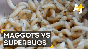 Are maggot secretions the secret weapon to fighting “superbugs?” | AJ