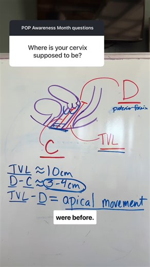 Dr. Margo K, DPT, CSCS, PCES | 🧠 Did you know we can objectively measure prolapse with a standardized exam? It’s called the POP-Q (Pelvic Organ Prolapse Quantification)... | Instagram