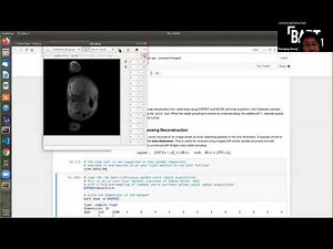 BART Webinar #1 Day 1 Part 3: GRASP-like MRI reconstruction