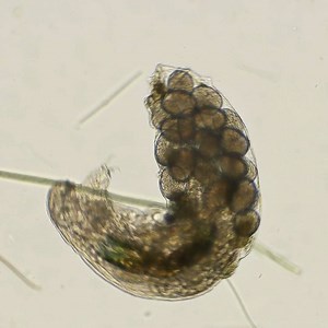 This is a pregnant water bear, we named her Maya. Maya has a wide variety of reproductive strategies that are both sexual and asexual in nature. Should Maya reproduce asexually, she will lay the eggs, and they will develop without fertilization. This process is known as parthenogenesis. #MicroscopicMonday 🐻🔬 | Science Channel