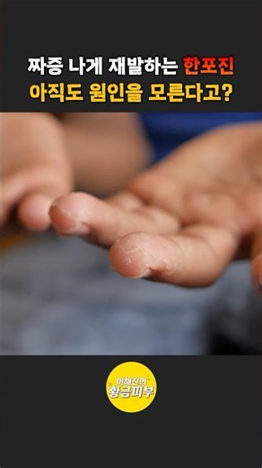 미친 가려움·자꾸 재발하는 한포진의 원인을 모른다?
