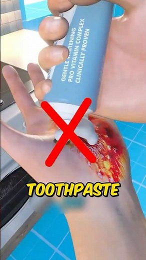 Burned Your Skin? Never Do This.