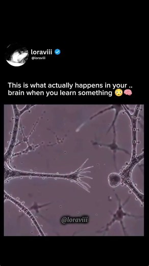 This is what your brain cells do when you learn something new.. 🧠