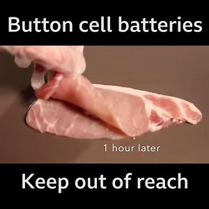 Wow 😱 A strong reminder to keep those little batteries out of reach. Public Health Agency | CBeebies Parenting