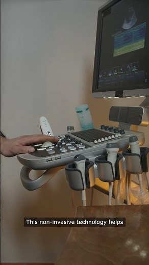 How Ultrasound Machine Works
