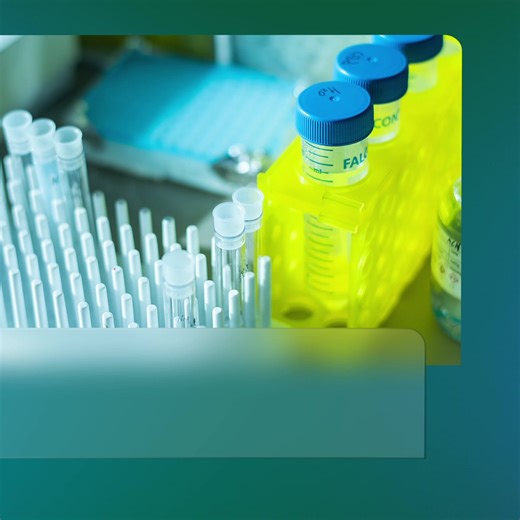 Wilson's disease is a potentially fatal condition that causes copper to build up in various organs. Joshua Bornhorst, Ph.D., explains how our labile copper blood test measures bioavailable copper and overall copper to identify this treatable disease. https://bit.ly/4ntkmzC | Mayo Clinic Laboratories