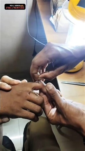 A thorn that is sewn into two fingers in succession