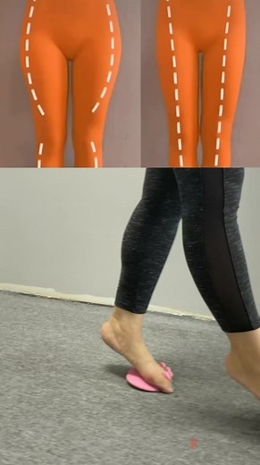 How to fix bowed legs quickly 💕#bowlegs #straightlegs
