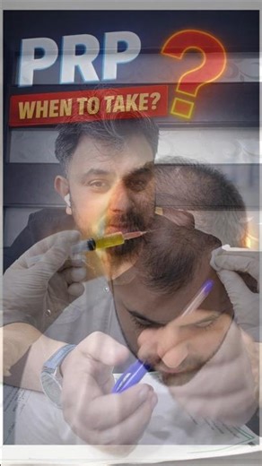 PRP Therapy Explained: When Should You Take PRP for Hair Loss Treatment #prp