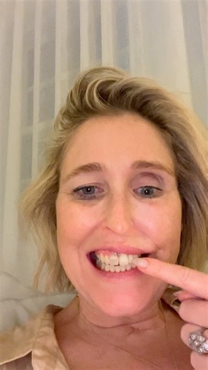 “I don’t like having a denture” Well news flash Susak, that is probably how that fine set of curated teeth are gonna feel about you if you don’t shift your mindset! I found this funny video I sent to my mum a few weeks ago when I was giving one of the denture versions a run privately at home. We made loads of versions before we hit the final one to parade in public settings. Our physical bodies are a direct print out of our thoughts of yesterday, I firmly believe that. How did I think I was goin