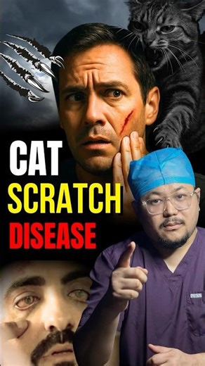 Cat Scratch can cause Serious Infection 😱 #cat #pets #facts #eyecare