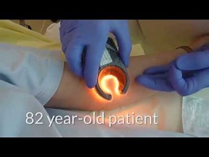 Finding Veins in Elderly Patient