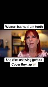 1M views · 3.5K reactions | Woman has no Front Teeth! But Chewing gum teeth 醴 #teeth #bad #dental #chewing | Global Stories | Facebook