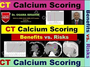 CT Calcium Scoring (benefits Vs. Risks)