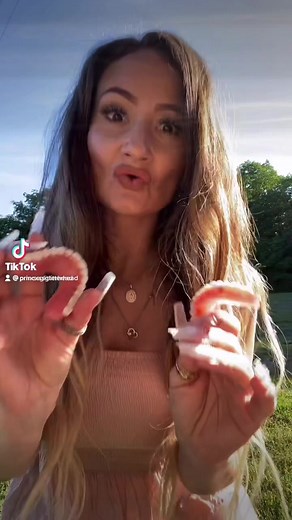 Honestly I fell in love with that #toothlesssmile & I would be lying if I said I didn’t already miss it❤️ But I see my finals for the first time next week so I’m getting super nervous & excited!! These are my #snapindentures on #miniimplants Full story is on YouTube #glitterheaddentaldiaries #toothlessprincess #denturequeens #implantqueen #implantdentistry https://linktr.ee/Princessglitterhead | Alicia Hebner